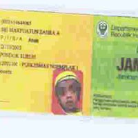Sri Empat Tahun Menderita Hidrocepohalus 