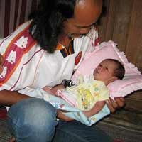 Bayi Kelainan Kelamin Lahir di Magetan 