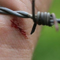 Luka yang Membawa Tetanus