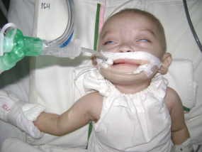 Tunggu Kondisi Stabil, Dokter Belum Berani Operasi Davina