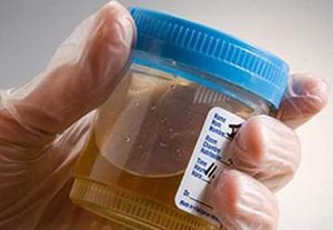 Bagaimana Terapi Urine Bisa Menurunkan Berat Badan?