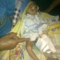 Terpaksa BAB Lewat Perut
