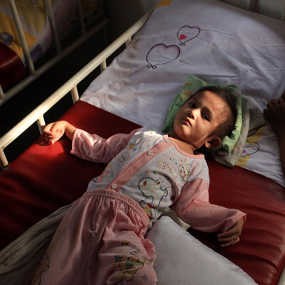 Kemiskinan Sebabkan Balita Gizi Buruk di Pulau Nias