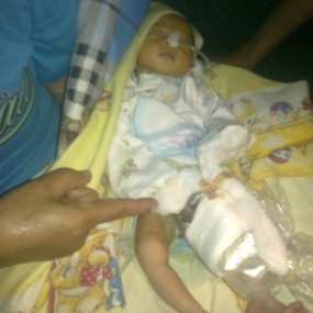 Belum Sempat Dioperasi, Nur Hadis Meninggal di RS Imanuel