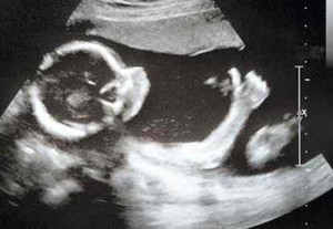 Bayi Beri Tanda Oke Saat USG