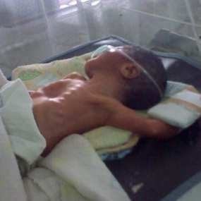 Tak Bisa Bertahan, Bayi Terakhir Pun Meninggal