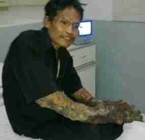 Keluarga Dede Menunggu Telepon dari RSHS