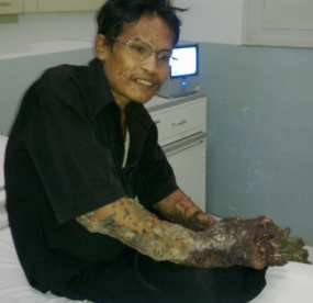 Diberi Obat Sembarangan, Dokter Minta Dede Segera Berobat