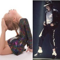 Badan Lentur Bak Michael Jackson Karena Sindrom Hipermobilitas