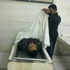 Korban Luka Sudah Bisa Berkomunikasi