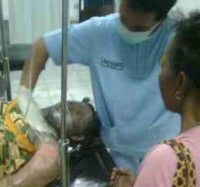 Kompor Ngebros, Pasutri di Ponorogo Terbakar