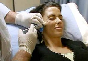 Suntik Botox Bisa Melumpuhkan Emosi