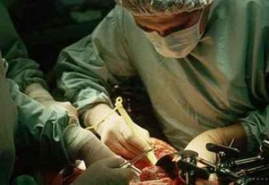 Kenapa Transplantasi Hati Sulit Diterapkan di Indonesia?