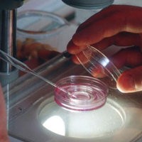 Membekukan Sel Telur Demi Pria yang Tepat