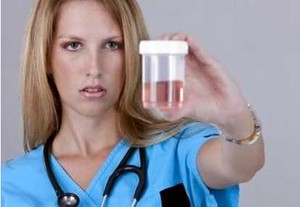 Warna Urine Bisa Jadi Indikator Kesehatan