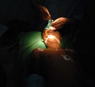 Operasi Membentuk Daun Telinga