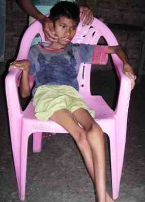 Polio Mendera, Agung Hanya Terkulai Lemah di Ranjang