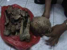 Kerangka Manusia Ditemukan dalam Karung di Lereng Bukit 