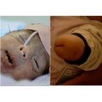 Kerusakan Genetik Anak Fallujah Lebih Parah dari Hiroshima