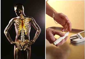 Pergantian Tulang Pengaruhi Diabetes
