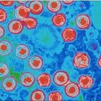 Virus Herpes Bisa untuk Obat Kanker