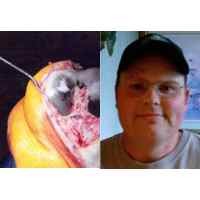 Dikira Rematik Ternyata Sendinya Menghitam