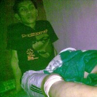 Jadi Korban Brutal Geng Motor, Betis Nano Dijahit 50 Jahitan