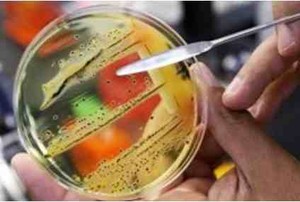 Bakteri Super yang Kebal Antibiotik Mengancam Dunia