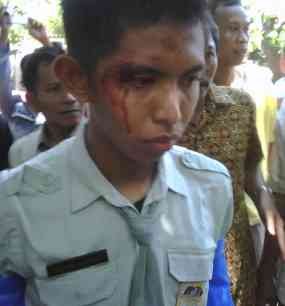 Polisi Berdalih Tak Ada Pemukulan, Korban Justru Langgar Lalin