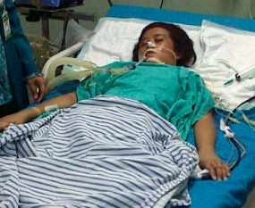 Guru SMP Kendal Terserang Penyakit Langka