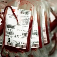 Pasien Anemia Berat Tak Perlu Transfusi Lagi dengan Terapi Gen