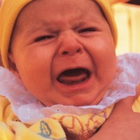 Curigai Bayi yang Kuning Lebih dari 2 Minggu