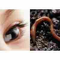 Bintik Aneh di Mata Selama 9 Bulan Tak Tahunya Cacing Giling