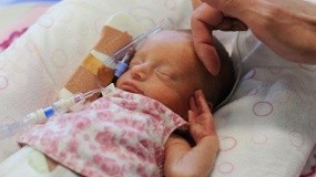 Ditinggal Mati Orangtua, Bayi Prematur Menghembuskan Nafas Terakhir