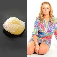 Payudara Meledak Karena Implan Murahan