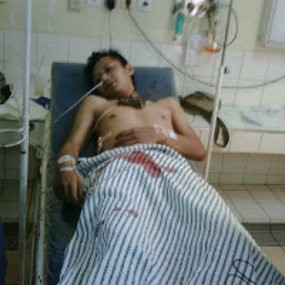Bentrok Geng Motor di Subang Memakan Korban 