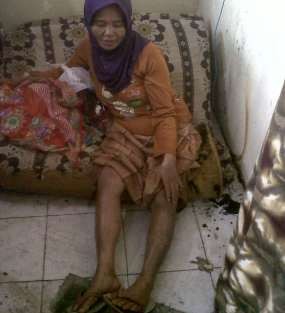 Korban Tak Cium Bau Gas, Tangan dan Kakinya Melepuh