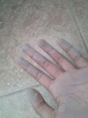 Abu Vulkanik yang Kena Mata Bisa Timbulkan Pedih