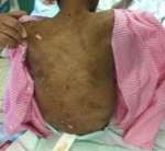 PKB: Langgar HAM, Majikan Sumiati Harus Dihukum Qishas