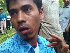 Serempetan Mobil, Anggota Brimob Pukul Sopir Taksi Hingga Berdarah