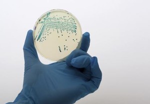 Dampak Serius Bakteri E.coli Lebih dari Sekedar Diare