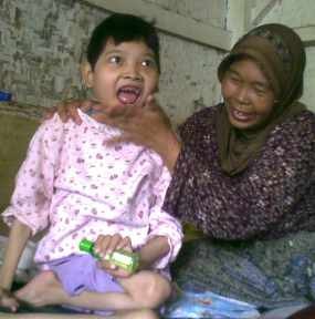 Dua Tahun Kumpulkan Uang Bantuan untuk Beli Kursi Roda