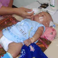 Bayi 5 Bulan Tak Sadarkan Diri Usai Imunisasi