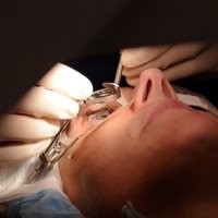 Obat Kanker Prostat Diduga Memicu Katarak
