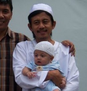 Komedian Epy Kusnandar Terserang Kanker Otak