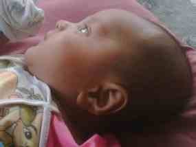 Daun Telinga Bayi Asal Sumenep Berbentuk Lafadz Allah