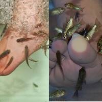 Penyuka Terapi Gigitan Ikan Harus Waspadai Ini