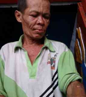 Dianiaya, Kusaeni Mengaku Lahir Batin Tidak Dendam 