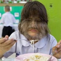 Supatra, si Gadis Monyet yang Berharap Bisa Sembuh