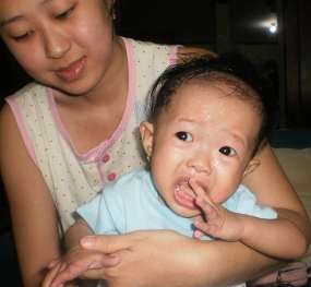  Menkes Turunkan Tim Investigasi Bayi Putus Jari